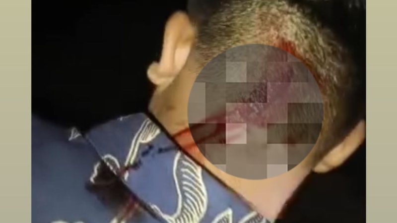 Pemilihan Presiden Mahasiswa UPP Ricuh, Ketua Timses 01 Bastian Sitompul Jadi Korban Penganiayaan Brutal