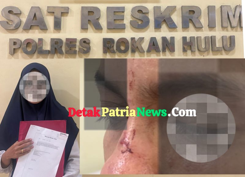 Sering Jadi Korban KDRT, IRT di Ujungbatu Laporkan Suaminya yang Seorang PNS ke Polres Rokan Hulu